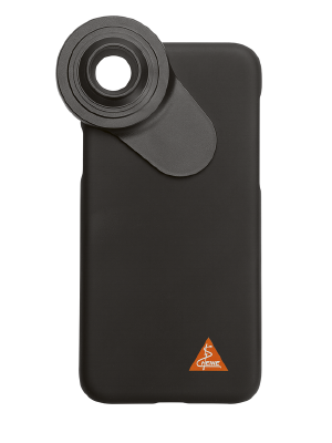 DELTA 30 & DELTAOne Dermatoscope Mounting Case for iPhone 11 Pro